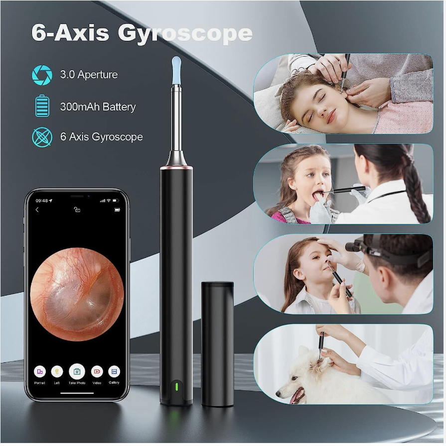 LED Ear Wax Cleaner Ear Camera Otoscope with Light Cleaner Removal Kit-Black